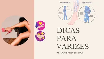 DICAS PARA VARIZES