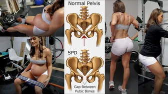 Work legs with SPD - NO MORE PAIN - 33 Weeks Pregnant