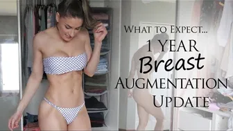 1 Year Update Post Breast Augmentation What to expect