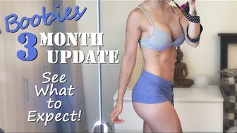 3 Month Update Post Breast Augmentation #1