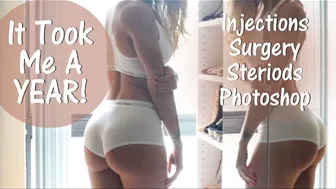 Took Me A Year Injections, Surgery, Steroids & Photoshop False Hope In The Fitness Industry