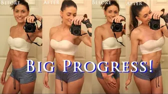 Progress Update Post Breast Augmentation Day 2, 5 & 7 Part 3 #1