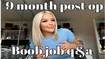 9 month post boob job Q&A????????