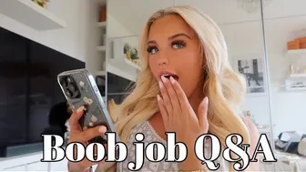 2 year boob job Q&A. ????☺️