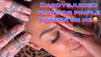 Pimple Popper on Hotrod Holly #1